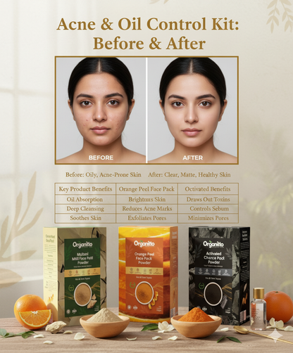 OIL CONTROL & ACNE FIGHTER KIT - Clear Skin in 4 Weeks